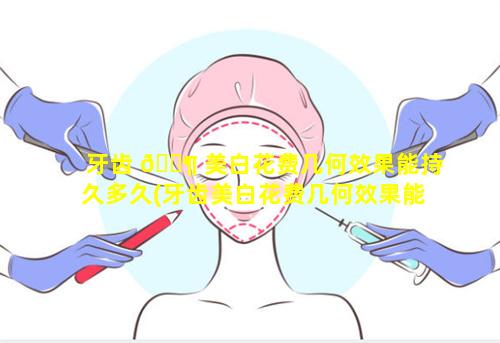 牙齿 🐶 美白花费几何效果能持久多久(牙齿美白花费几何效果能持久多久呢)